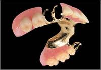 Partial Denture